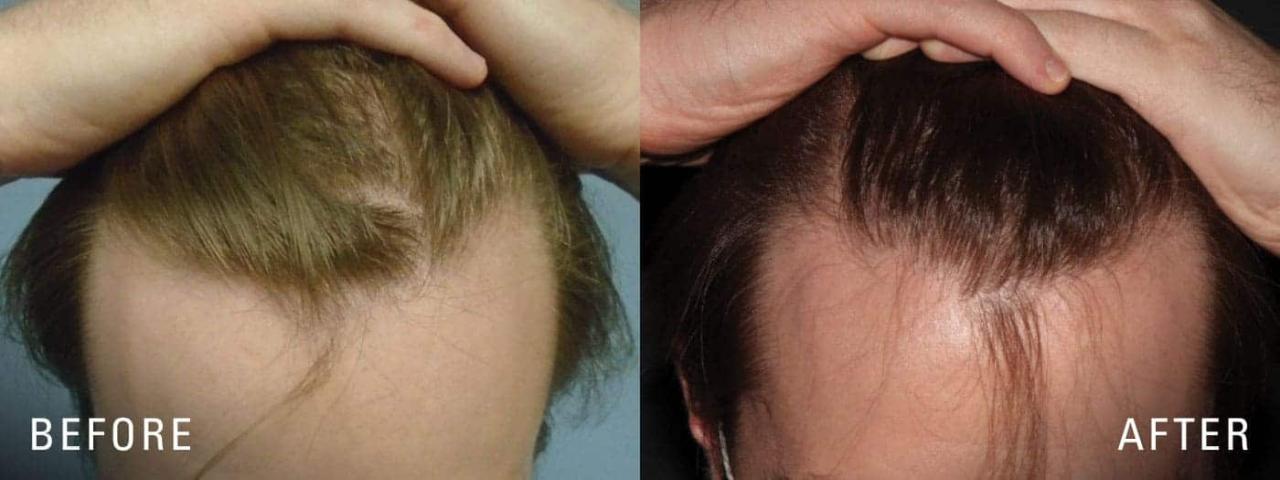 Illume cosmetic surgery