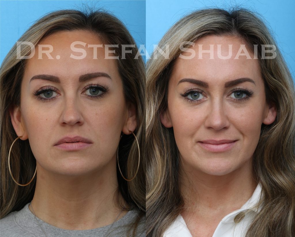 14 | Dallas Facial Plastic Surgery Center