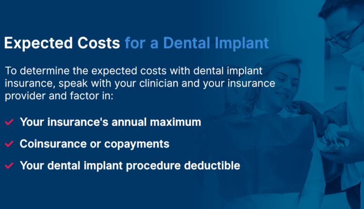 Dental Implants Insurance Coverage - Complete Dental Dental Implants Insurance Coverage - Complete Dental