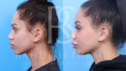 Center For Cosmetic Surgery Golden Co Elevating Beauty