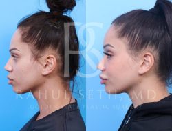 Center For Cosmetic Surgery Golden Co Elevating Beauty