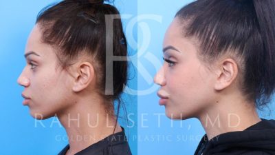 Center for cosmetic surgery golden co