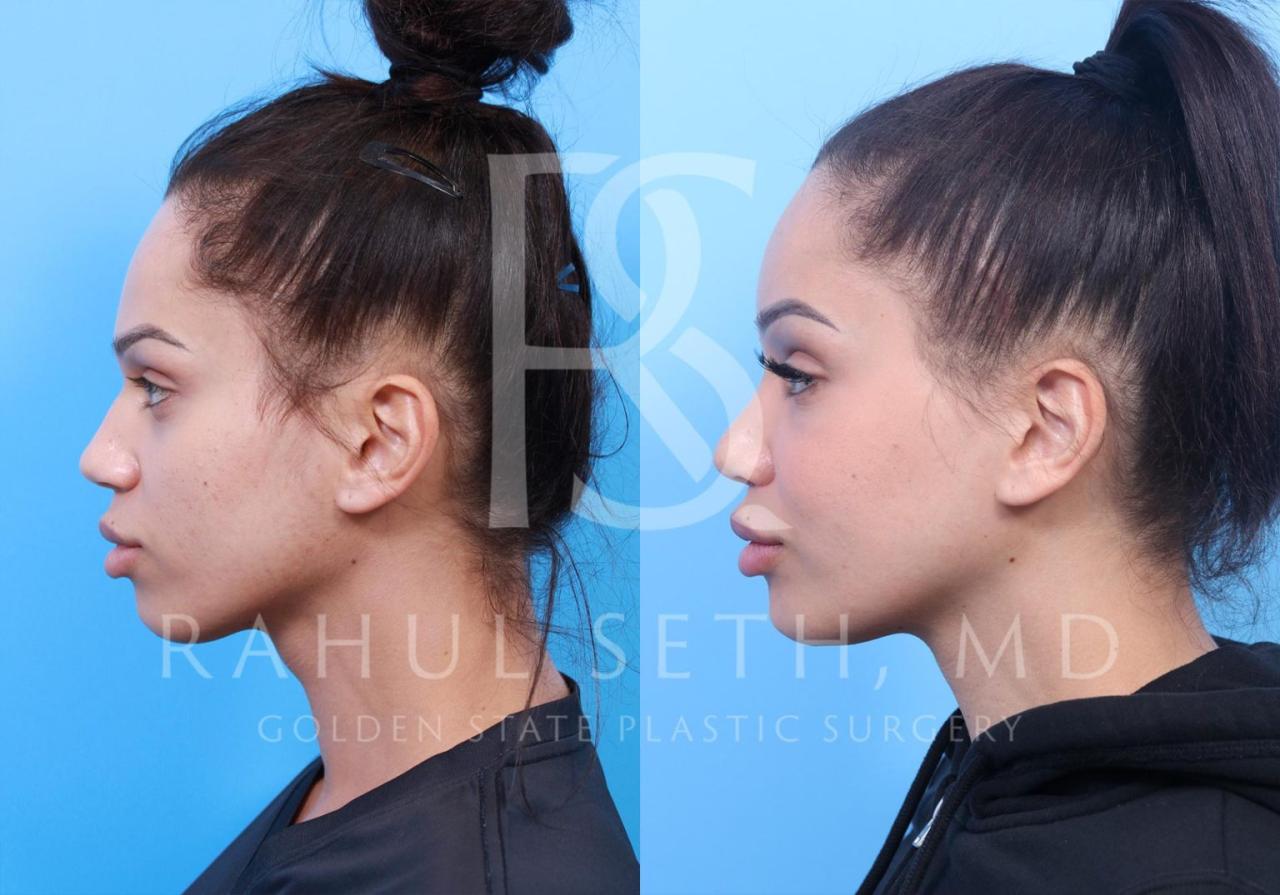 Center for cosmetic surgery golden co